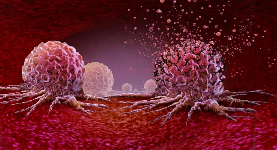 Treino de 30 Minutos que Pode Reduzir em 30% o Crescimento das Células Cancerígenas