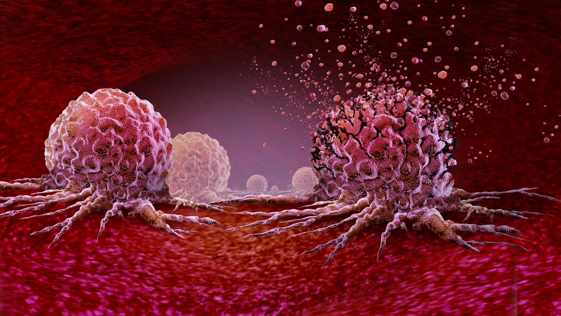 Treino de 30 Minutos que Pode Reduzir em 30% o Crescimento das Células Cancerígenas