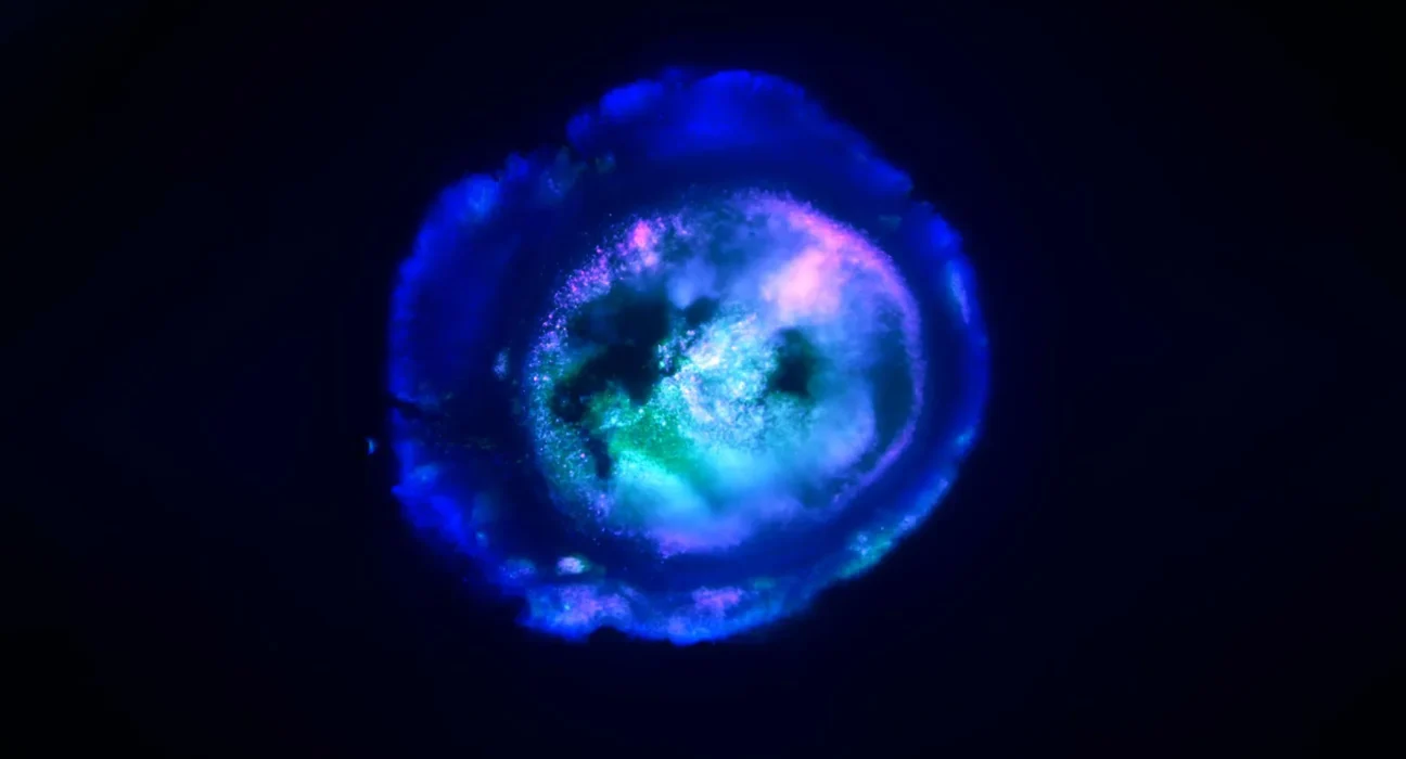 Cientistas da Johns Hopkins cultivam um mini cérebro humano que se ilumina e se conecta como o real