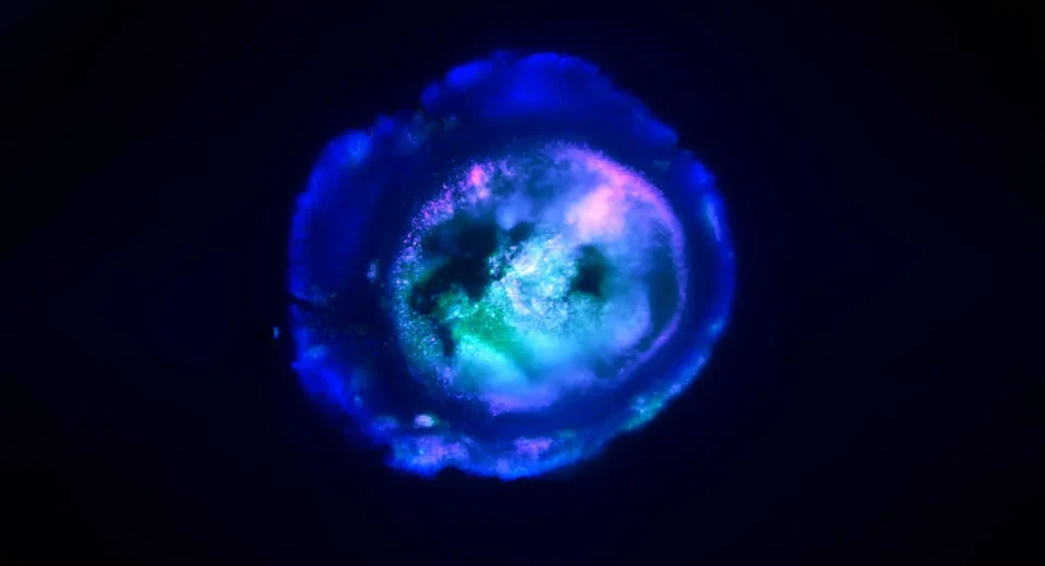 Cientistas da Johns Hopkins cultivam um mini cérebro humano que se ilumina e se conecta como o real