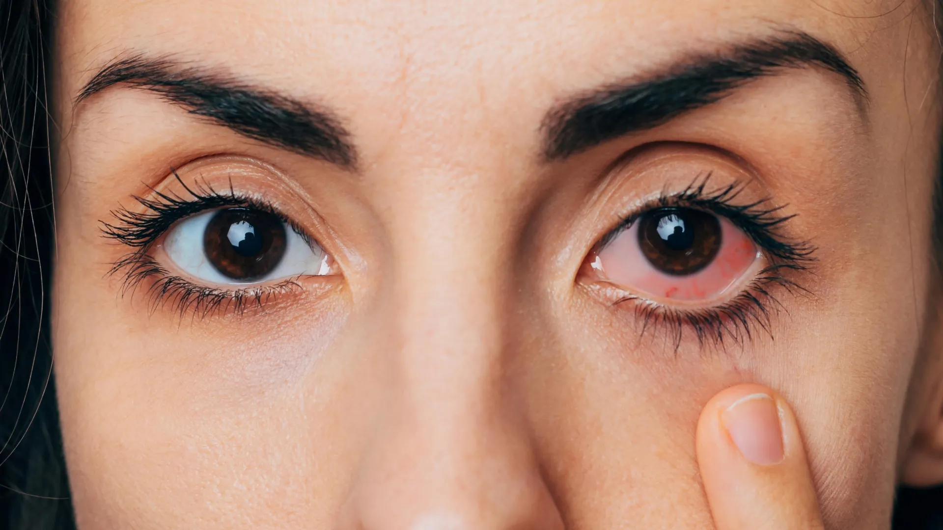 Metade dos adultos sofre de olhos secos, mas a maioria nunca procura ajuda