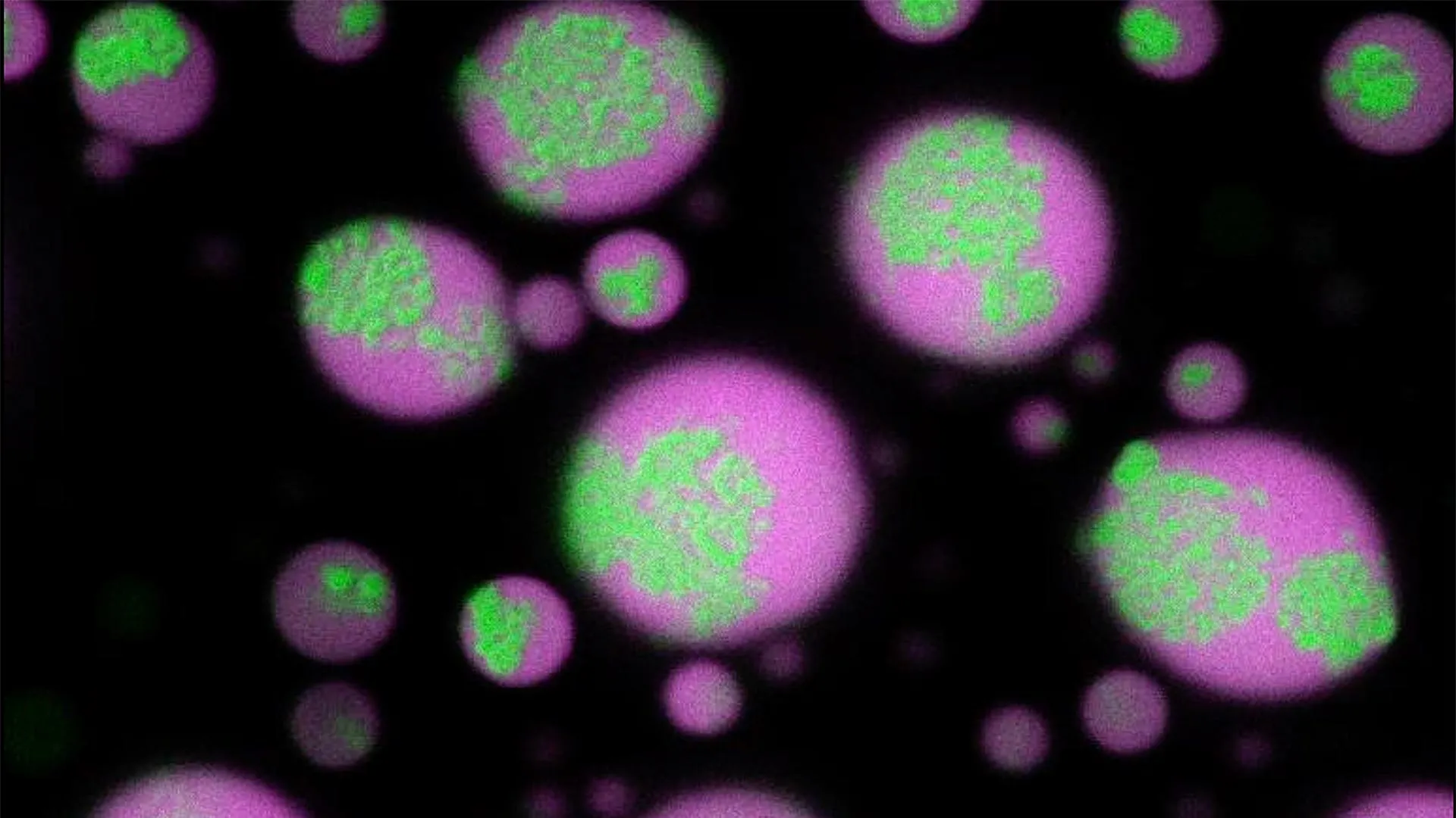 Cientistas Desvendam o Mistério dos Grupos de Células Cerebrais e Fazem com que Eles Desapareçam