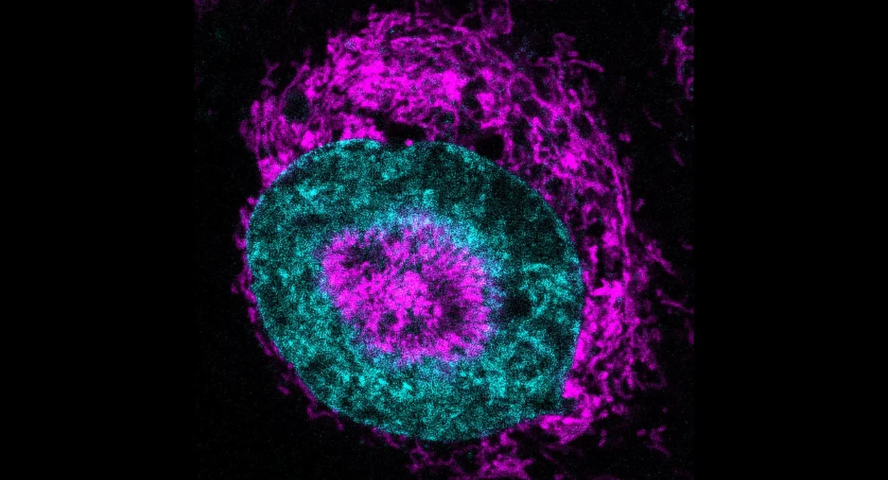 Cientistas descobrem fonte de poder oculta das células cancerígenas