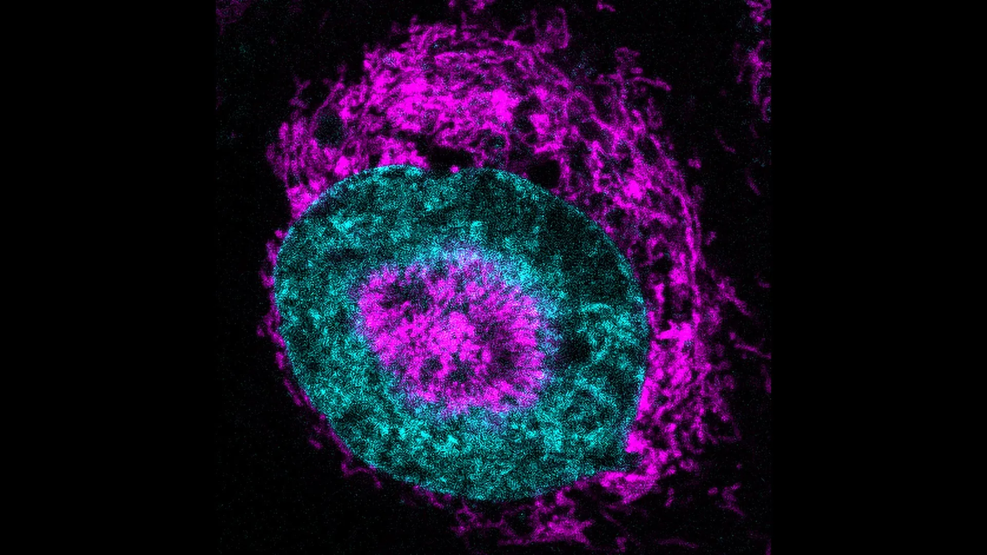 Cientistas descobrem fonte de poder oculta das células cancerígenas