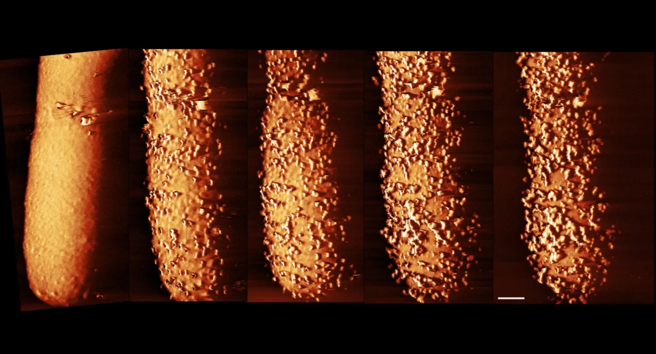 Imagens impressionantes revelam como os antibióticos destroem as defesas bacterianas