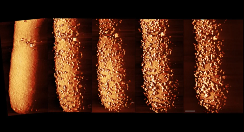 Imagens impressionantes revelam como os antibióticos destroem as defesas bacterianas