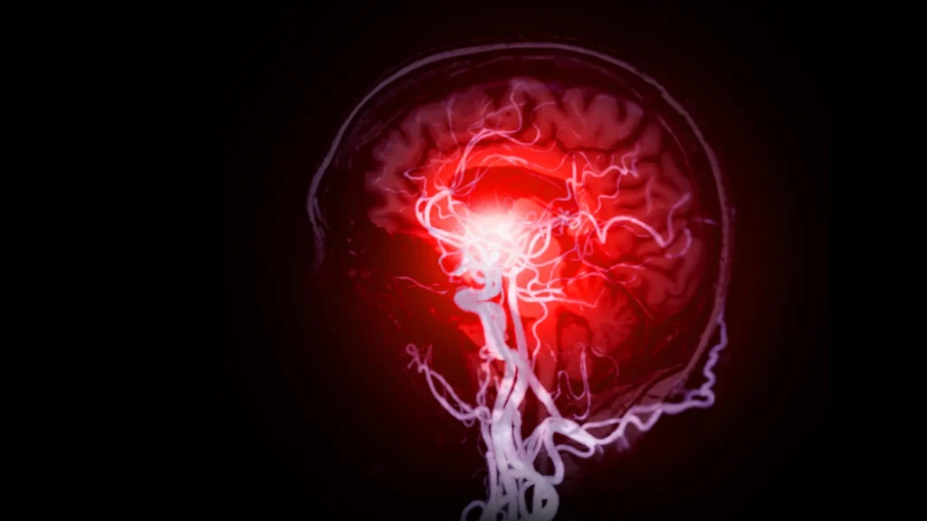 Cientistas Descobrem Danos Cerebrais Ocultos por Trás da Demência