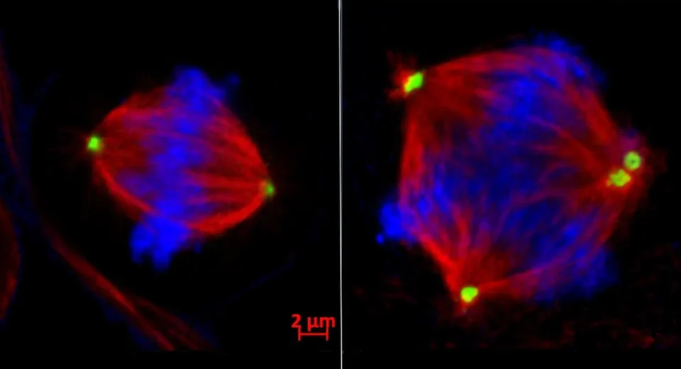 Esta 'enzima do caos' pode ser a chave para impedir a disseminação do câncer