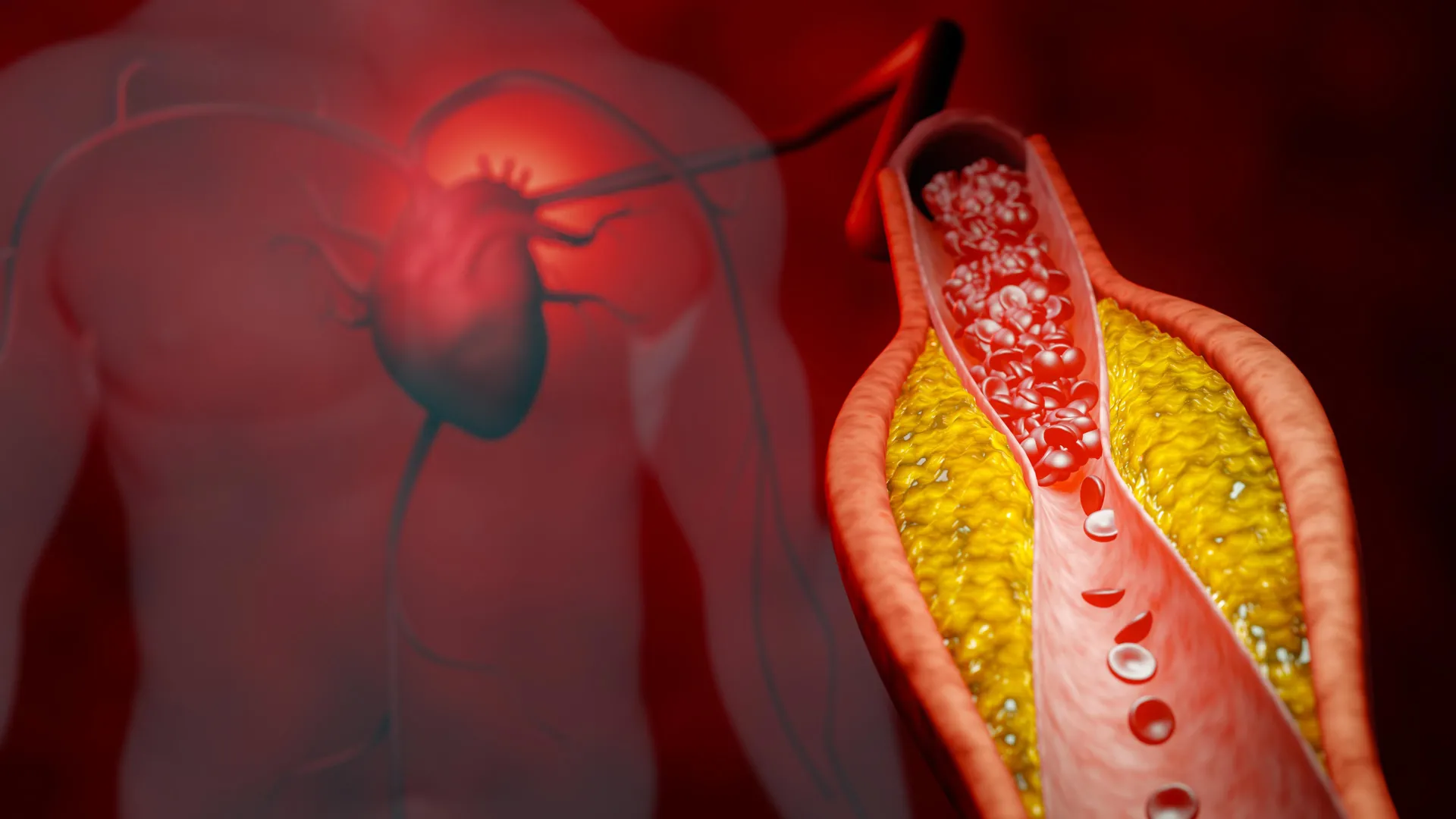 Novo tratamento reduz colesterol em quase 50%, sem estatinas e sem efeitos colaterais