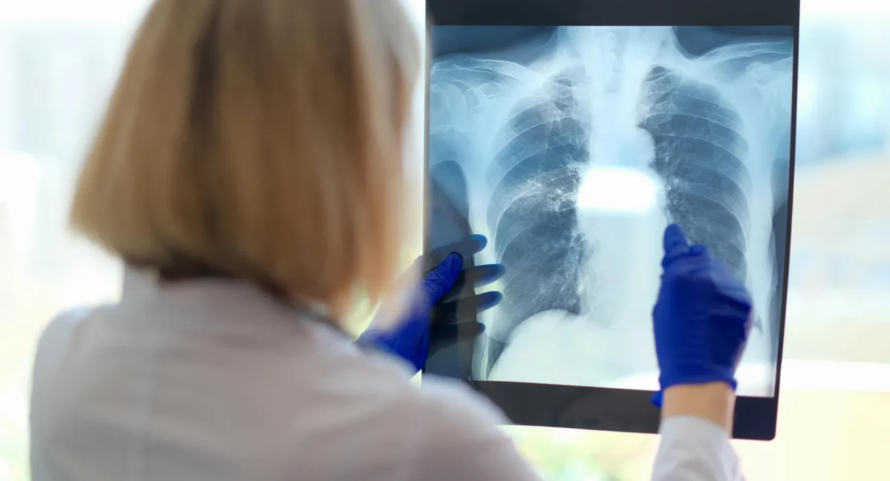 Um problema respiratório oculto pode ser a causa da exaustão debilitante da fadiga crônica