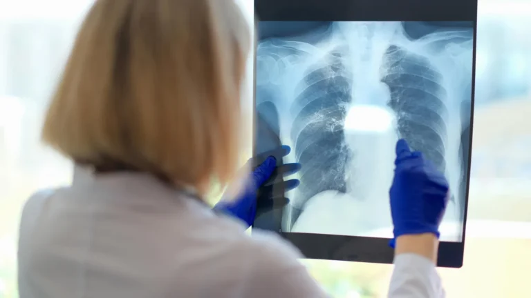 Um problema respiratório oculto pode ser a causa da exaustão debilitante da fadiga crônica