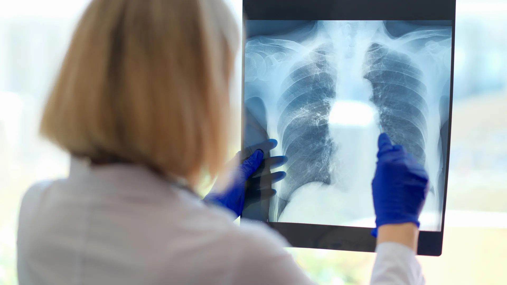 Um problema respiratório oculto pode ser a causa da exaustão debilitante da fadiga crônica