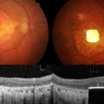 Benfica derrota Marítimo por 5-0 na Liga Feminina