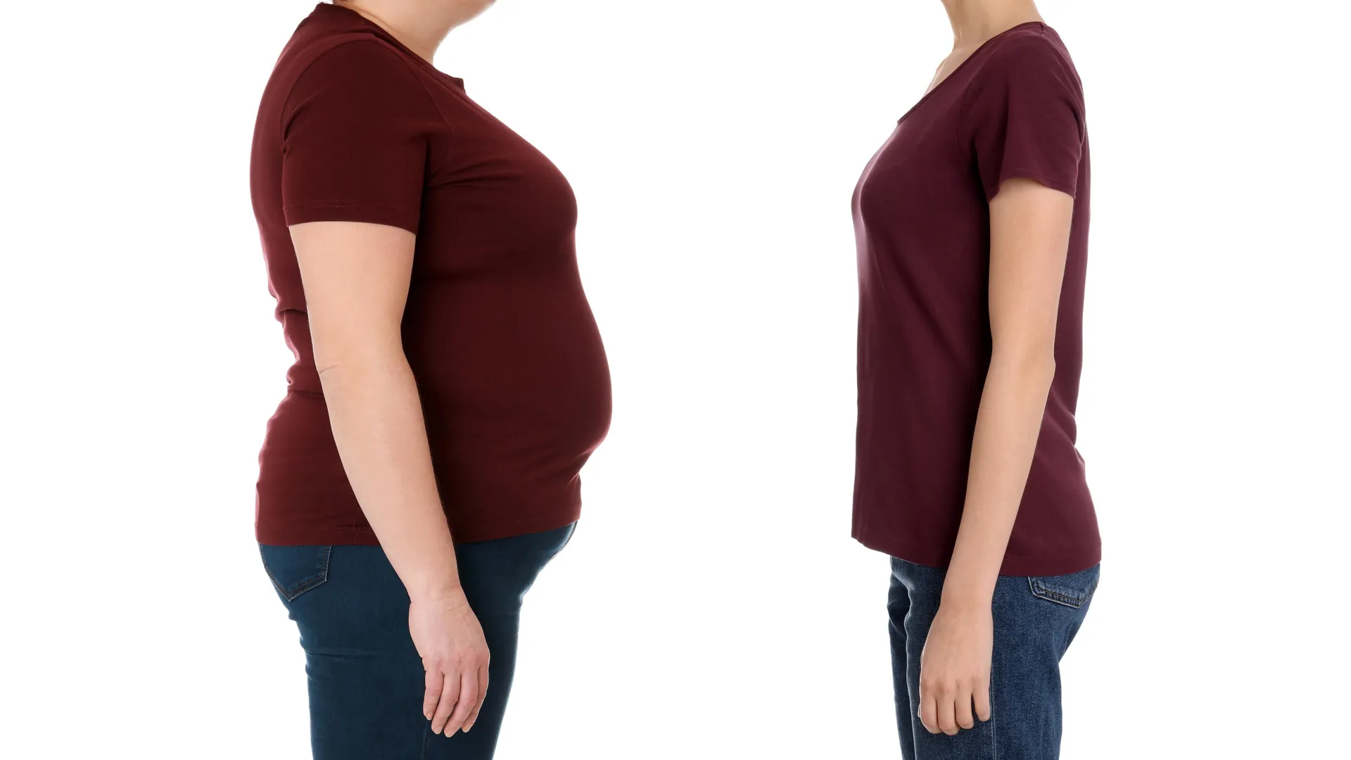 Cirurgia supera Ozempic para saúde a longo prazo, conclui Cleveland Clinic