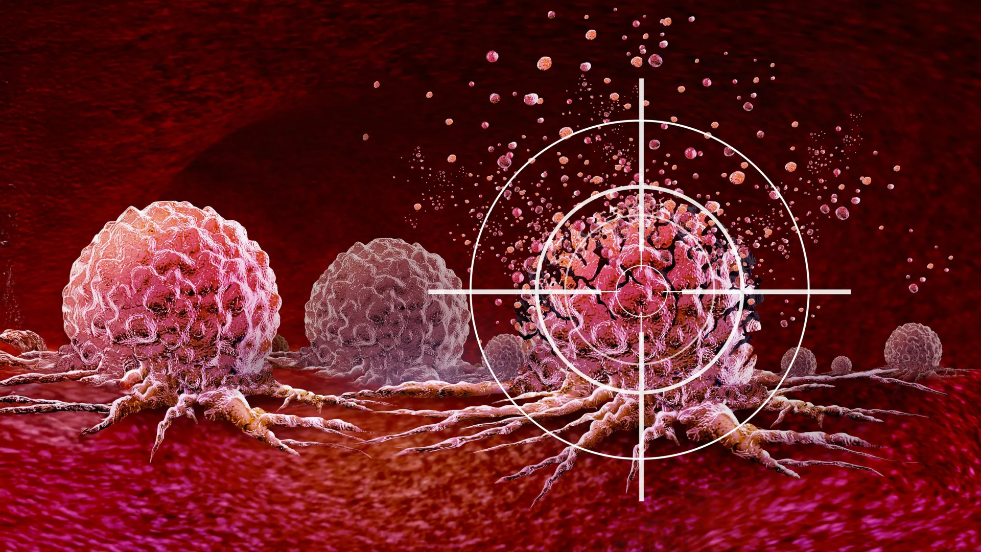 Droga inteligente ataca um ponto fraco oculto do RNA em células cancerígenas