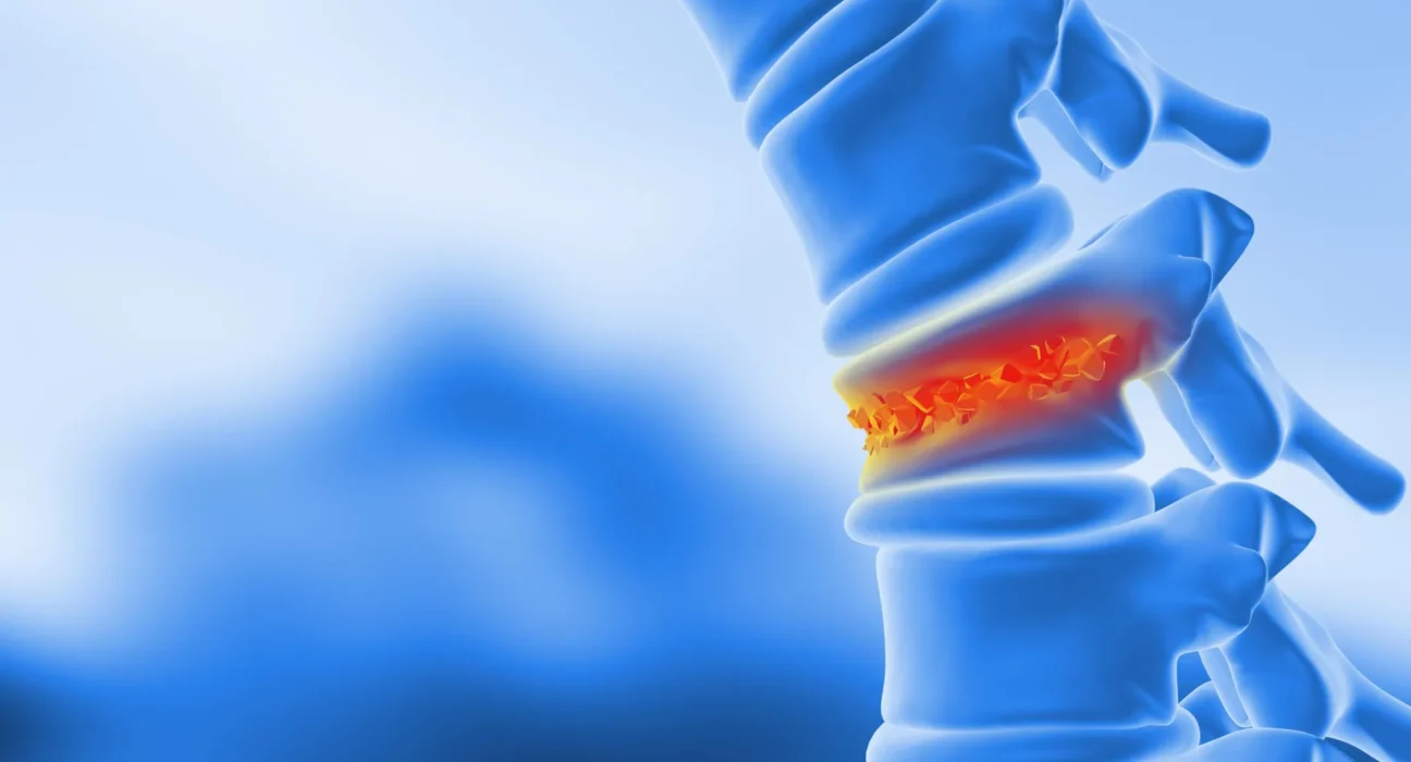 CientistasTransformam Gordura Corporal em Osso para Curar Fraturas na Coluna Vertebral