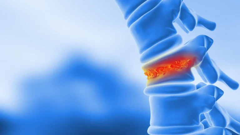 CientistasTransformam Gordura Corporal em Osso para Curar Fraturas na Coluna Vertebral