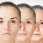 Onde as lojas de cannabis se concentram, aumentam as visitas de emergência