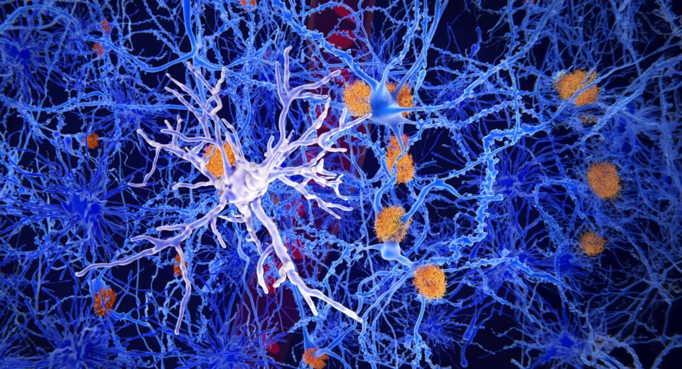 Cientistas descobrem células cerebrais que podem impedir Alzheimer