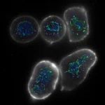 Os alertas ocultos de doenças que a IA da Stanford detecta enquanto você dorme