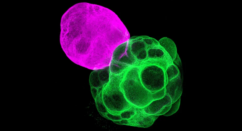 Cientistas japoneses criam circuitos do cérebro humano em laboratório