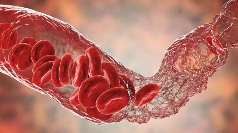 A Long COVID pode ser alimentada por inflamação e pequenos coágulos