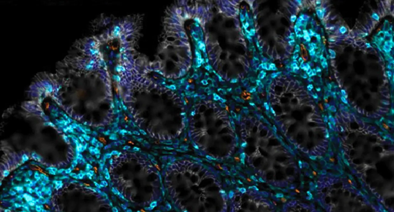 Cientistas descobriram uma maneira de ajudar os intestinos envelhecidos a se curarem sozinhos