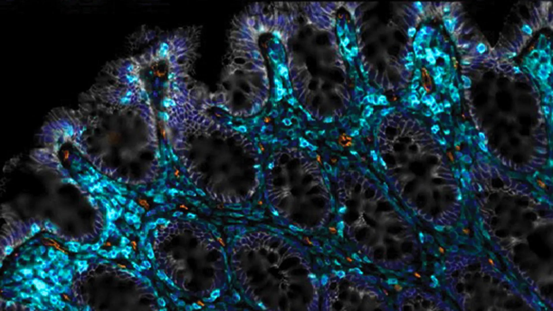 Cientistas descobriram uma maneira de ajudar os intestinos envelhecidos a se curarem sozinhos