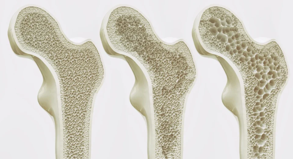 Cientistas podem ter encontrado uma maneira de manter seus ossos fortes para a vida toda