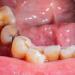 Amadora Aprova Relatório de Gestão 2025: Rigor Financeiro e Investimentos Históricos em Habitação e Educação