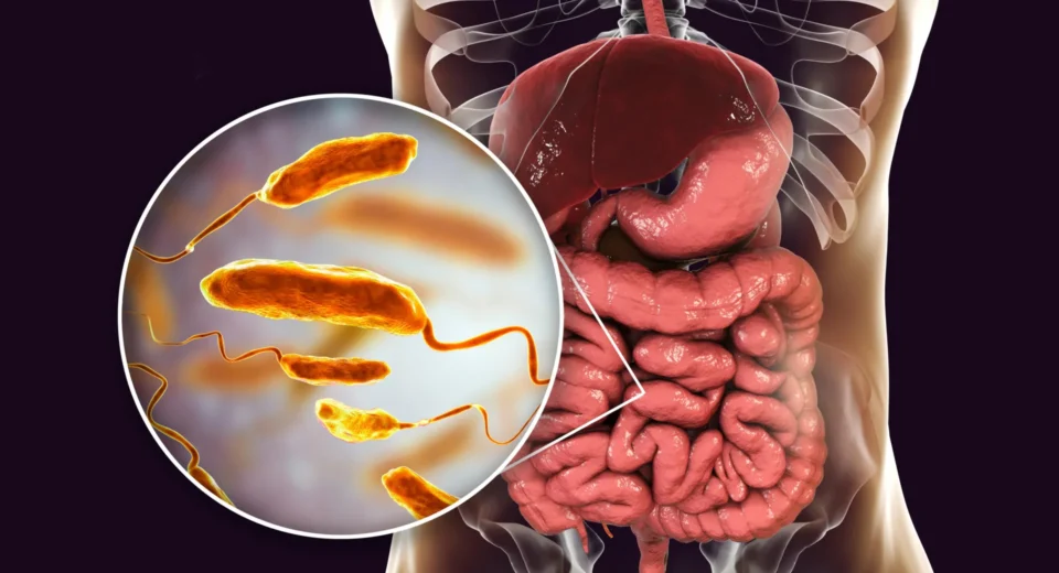 Esta dieta pode reduzir infecções por cólera em até 100 vezes